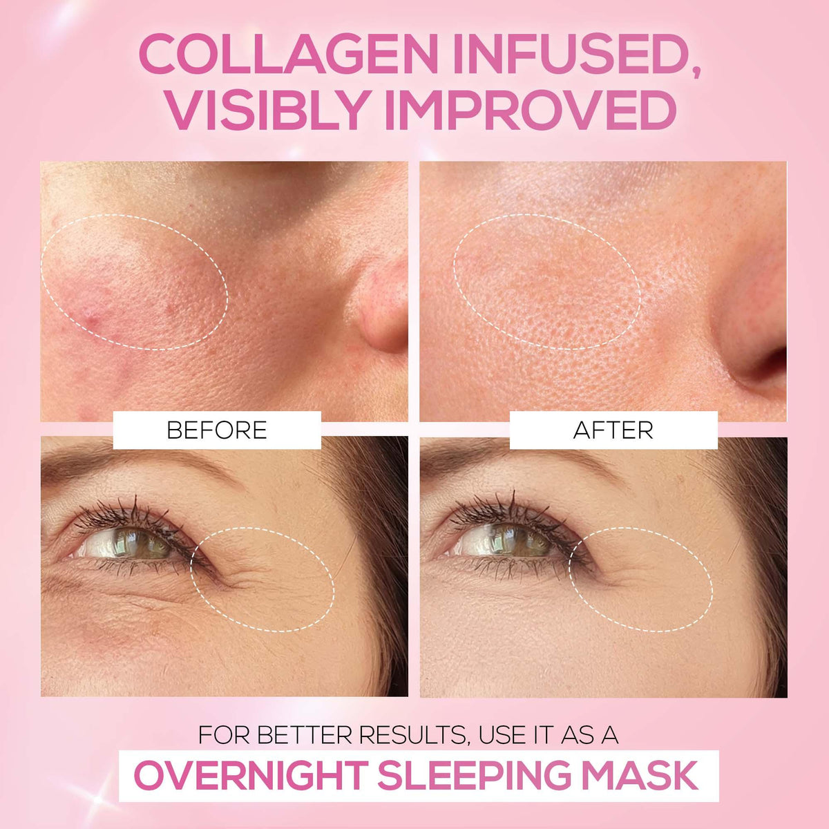 RENEE Pink Therapy Hydrolyzed Collagen Jelly Cream For Anti-Aging & Hydrated Skin